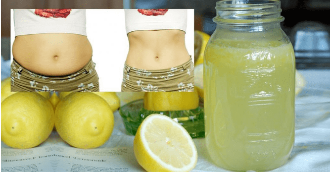 Meáchain caillteanas Lemona